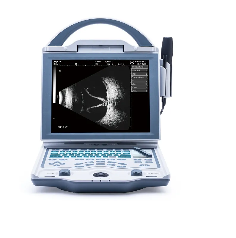 Ultrasound Device 2