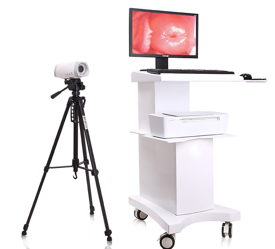 My-F004 Hospital Electronic Handheld Digital Video Colposcope