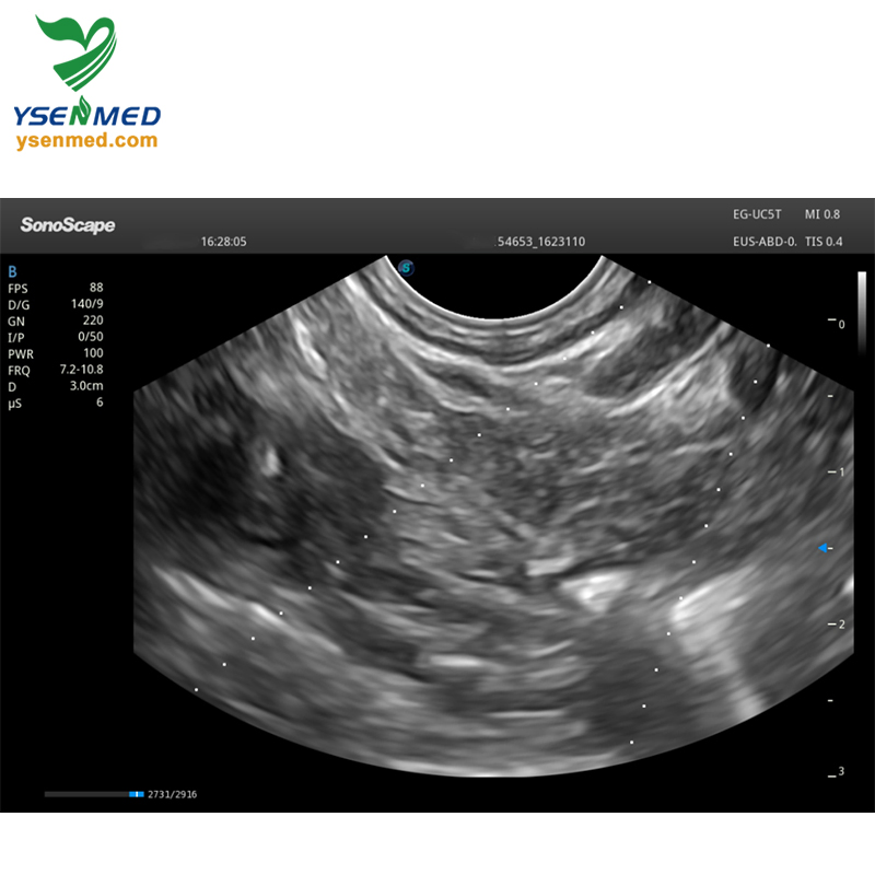 Medical Equipment Sonoscape Eg-UC5t, Linear-Array Echoendoscope Video Endoscopy System