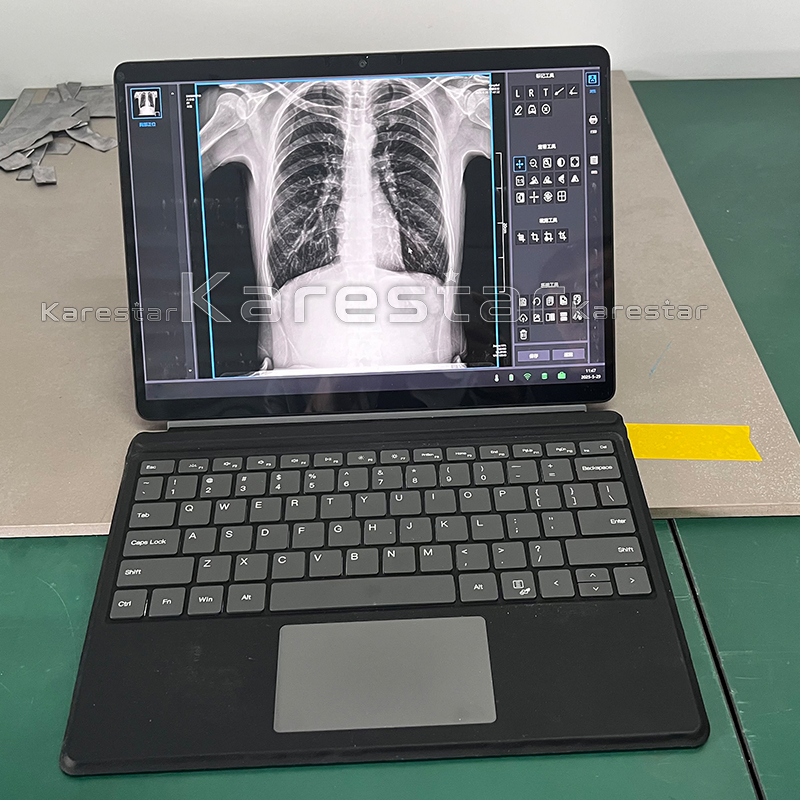 K-Dx70 Portable Medical X Ray Digital Machine for Human Use Cheapest Hospital Clinic X Ray Machine Price