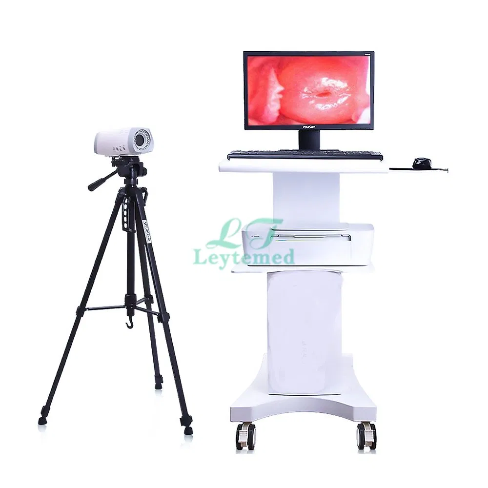 Ltec03 Trolley Video Colposcope