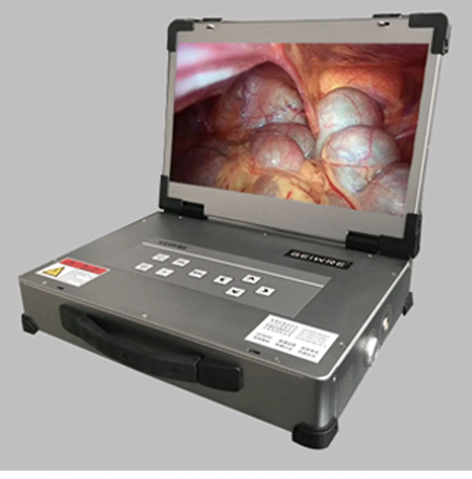 Medical Integrated Endoscopy with Full HD Endoscope Camera System