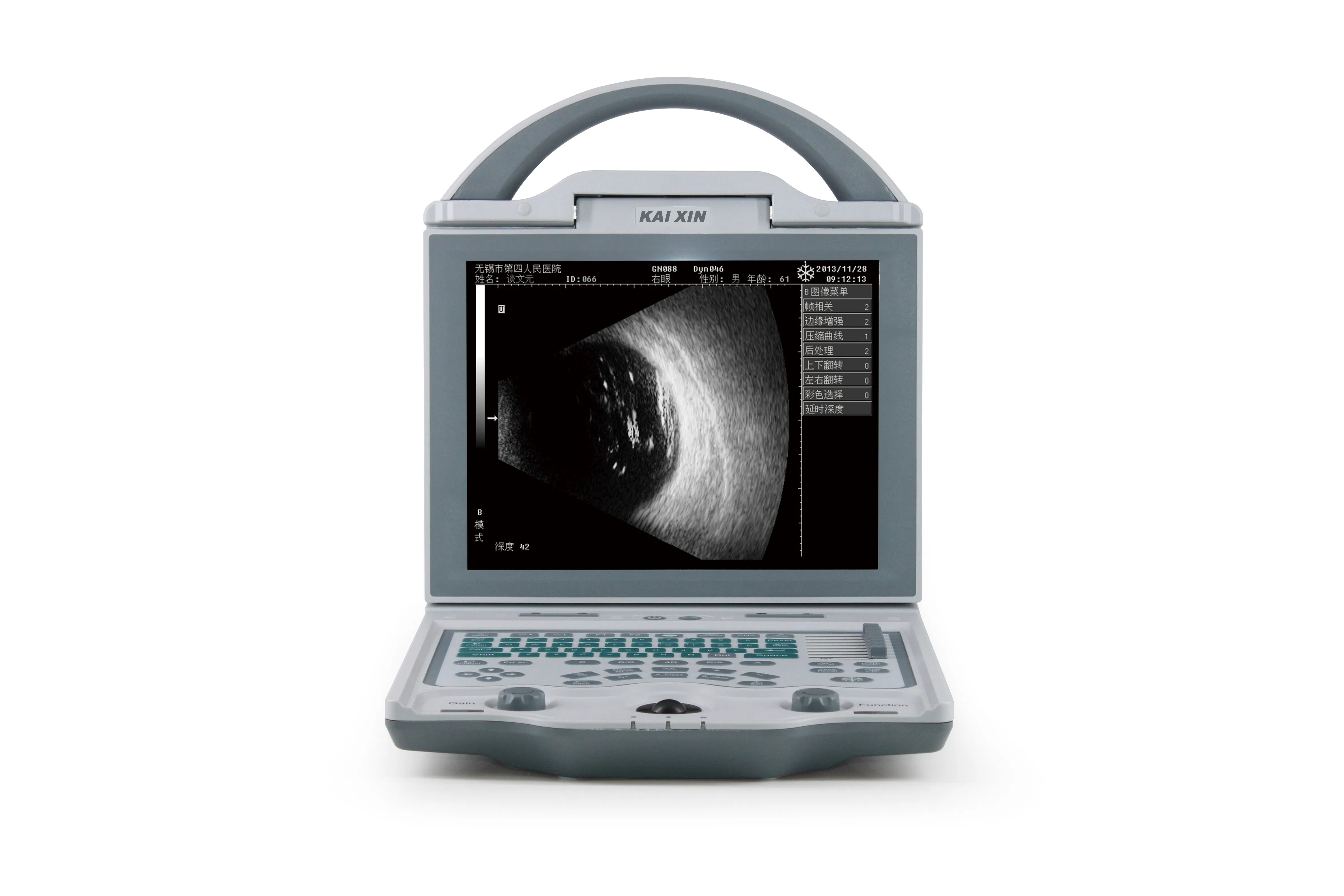 Efficient Eye Ultrasound Device with a/B Scan for Advanced Ophthalmology Use