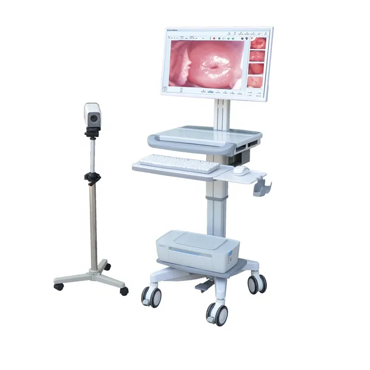 Full HD Portable Video Colposcope