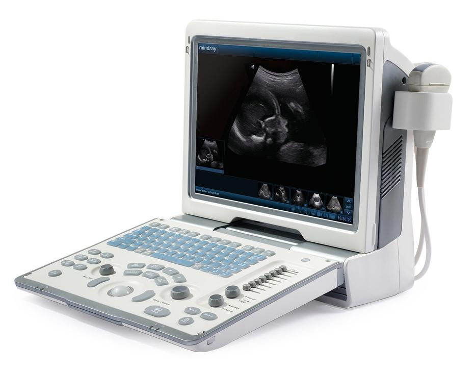 Medical Apparatus Digital Ultrasonic Diagnostic Imaging System