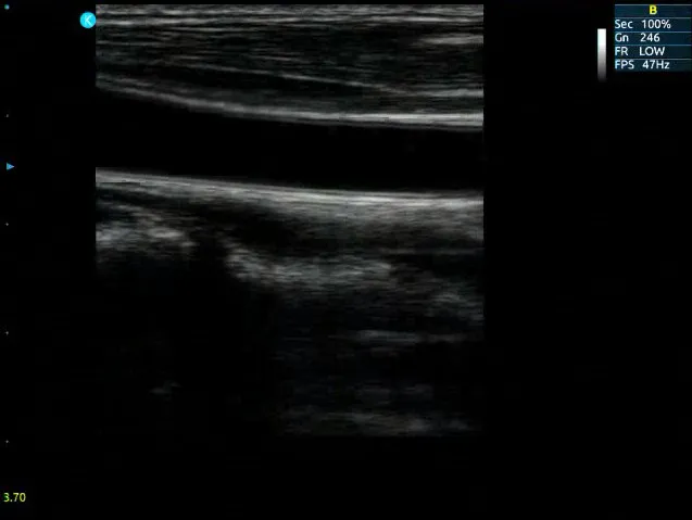 Tissue Harmonic Imaging