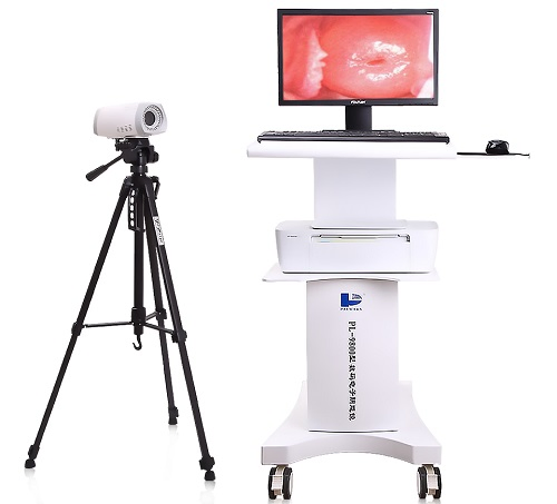 Medical Equipment Colposcope for Gynecology Pl-9800t