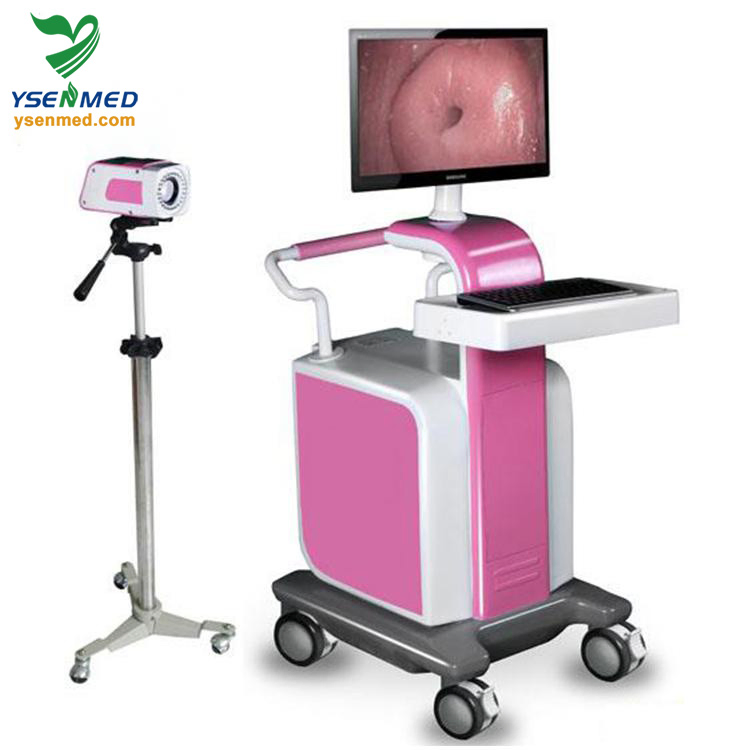 Ysenmed Medical Equipment Yssw3303A Digital Optical Colposcope