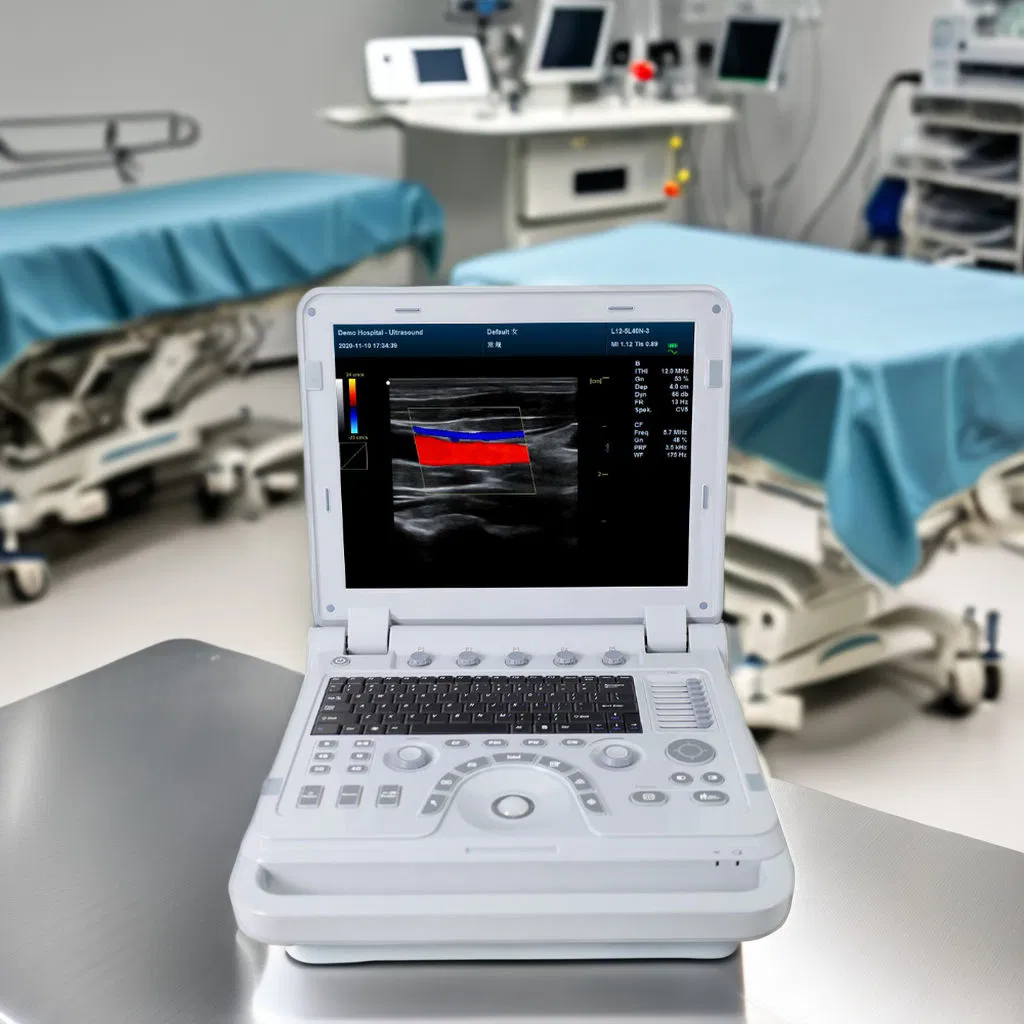 High-Quality Portable Veterinary Ultrasound Device for Accurate 3D Imaging