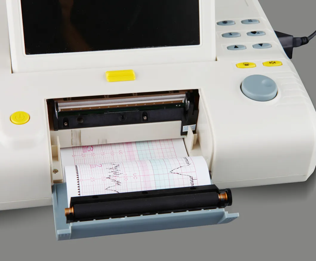 Fetal Monitor Detail 2