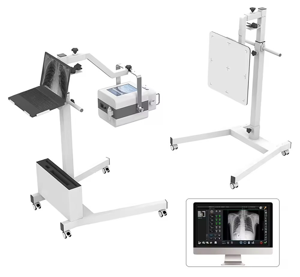 5.6kw Portable Digital Radiography X Ray Machine for Medical Screening in Veterinary and Human Use