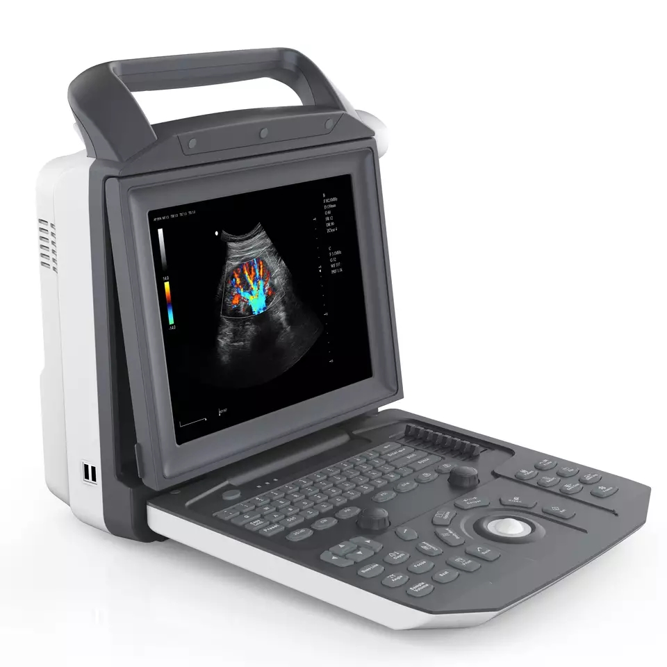 Obstetrics Gynecology Cardiac Portable Ultrasound Machine Full Digital Ultrasonic Diagnostic Imaging System