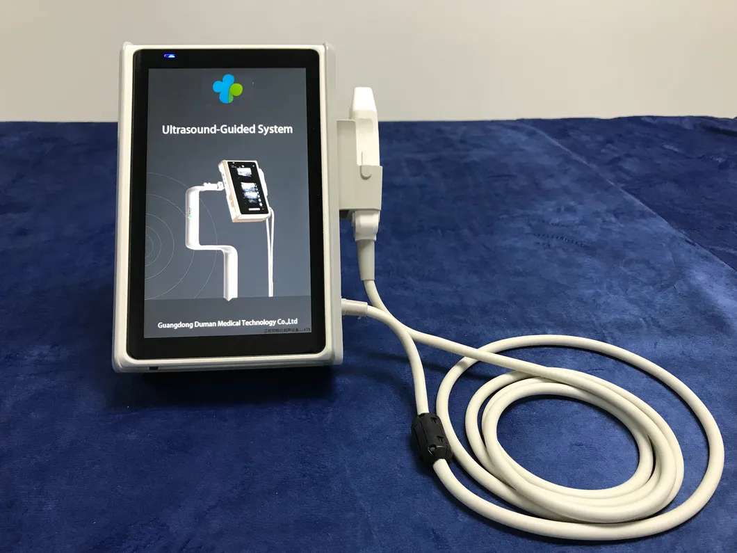 Vascular Access Catheter Ultrasound-Guided System