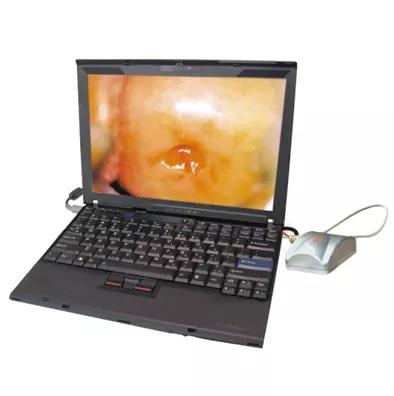 Digital Mobile Portable Vaginal Endoscope Gynecological Diagnostic Video Colposcope