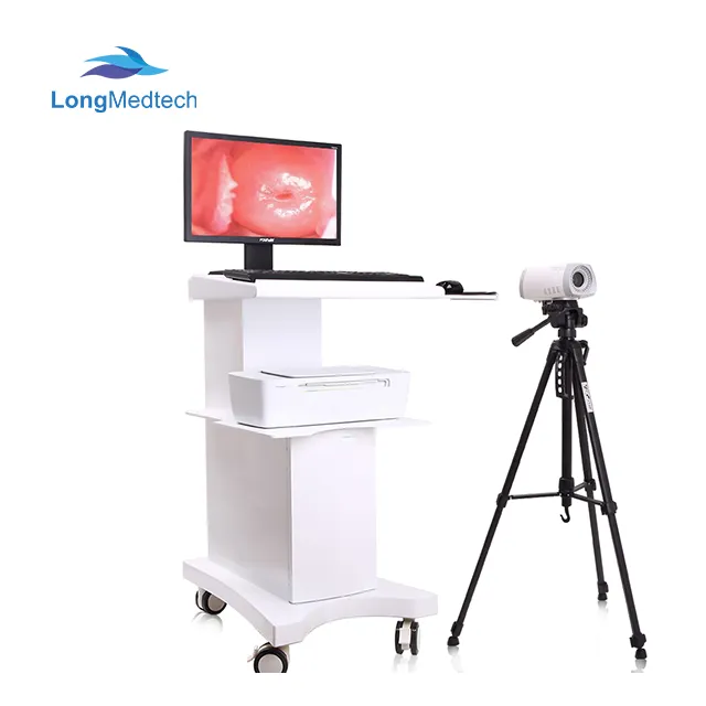 Trolley Video Colposcope 1