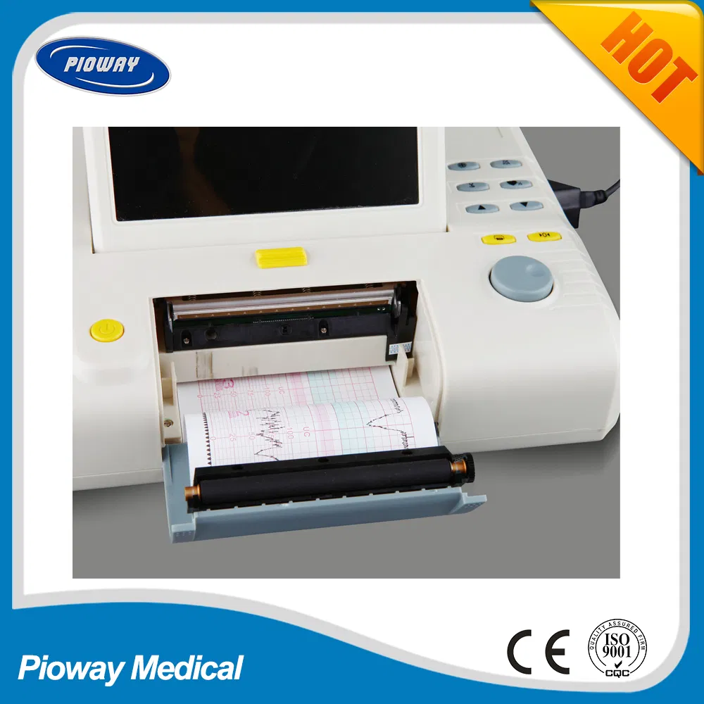 Portable Fetal Doppler Monitor for Easy Baby Heartbeat Tracking