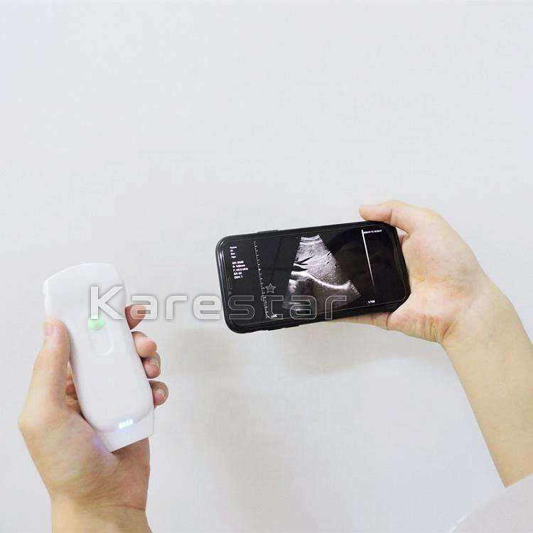 3 in 1 Color Doppler Wireless Probe WiFi and USB Ultrasound Device