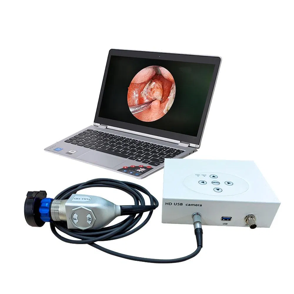 IN-HD7020 Surgical Hospital Medical Endoscopy Full Hd Digital Ent Endoscope Camera Ready To Ship All-in-one Endoscope Camera System