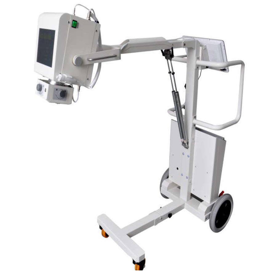 Human Portable Chest Xray Mobile Medical X-ray Equipments Dr Digital Portable X Ray Machine Price