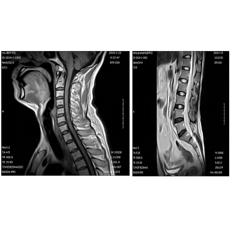 Xmr030 Radiology Providing Space for Mr Intervention Surgery 0.3t Permanent Mgnet MRI Scanner