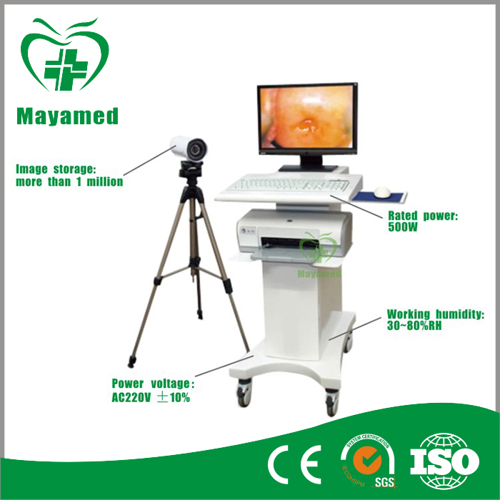 My-F004 Hospital Electronic Handheld Digital Video Colposcope