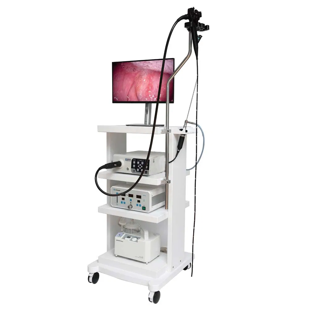 Animal Hospital Video Gastroscopy Endoscope Camera Equine Veterinary Endoscope System Gastrointestinal Endoscopy