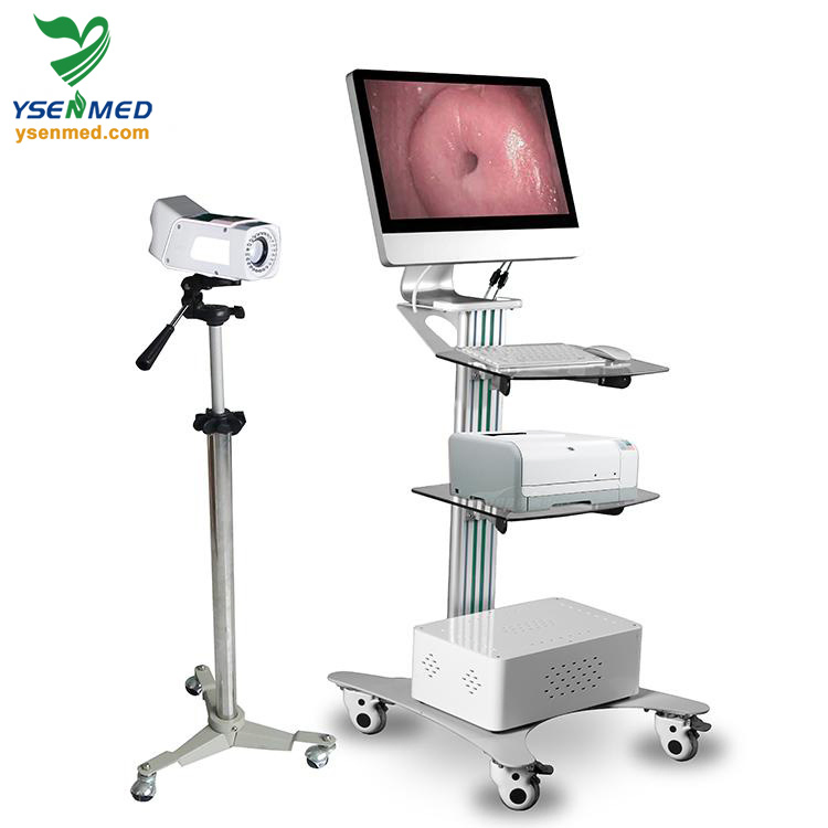 Ysenmed Medical Equipment Yssw3303A Digital Optical Colposcope