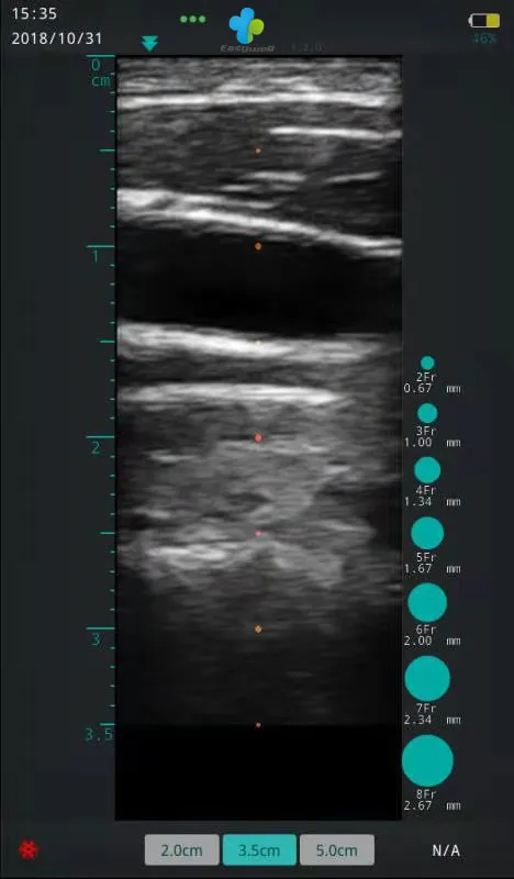 Ultrasound Image 2