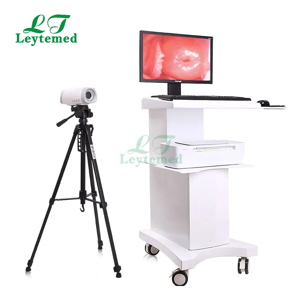 Ltec03 Trolley Video Colposcope