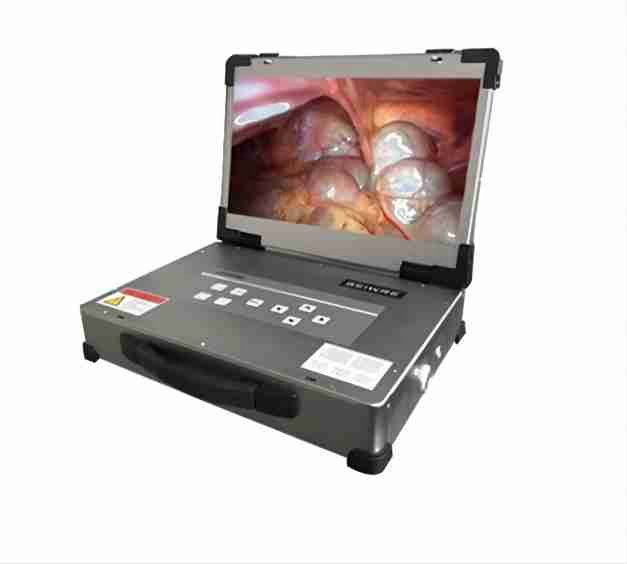 Medical Integrated Endoscopy with Full HD Endoscope Camera System