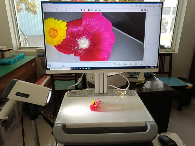 Ouman Full HD Portable Video Colposcope Vaginal Colposcopy Medical Device