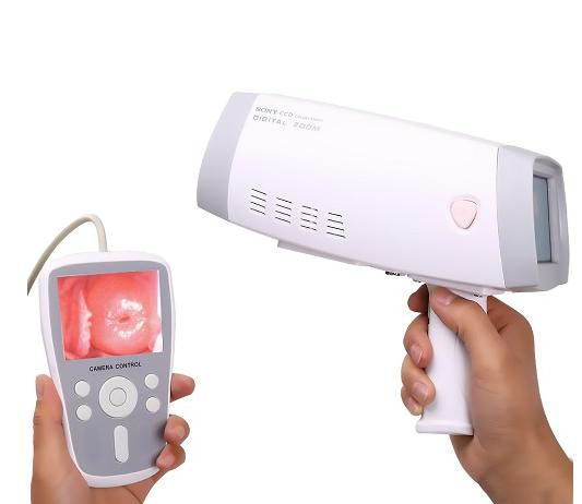 Digital Portable Video Colposcope Pl-9800b