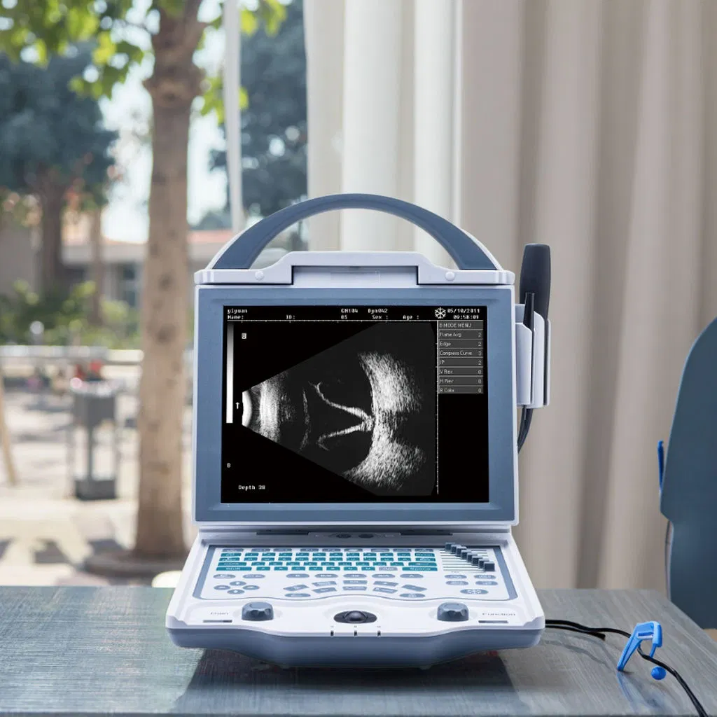 Compact Ophthalmic Ultrasound Device for Portable Eye Health Monitoring