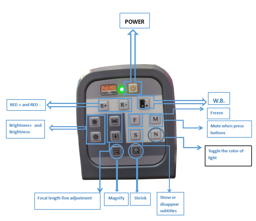 Ouman Full HD Portable Video Colposcope Vaginal Colposcopy Medical Device