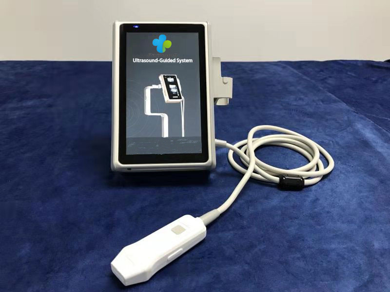 Vascular Access Catheter Ultrasound-Guided System Ew-V1 Ultrasound Device