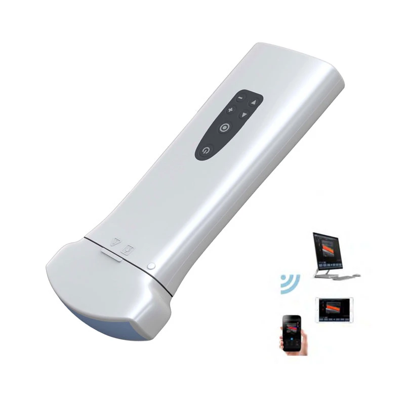 My-A010L China Manufacturing Mini Pocket Wireless WiFi Probe Ultrasound Handheld Device