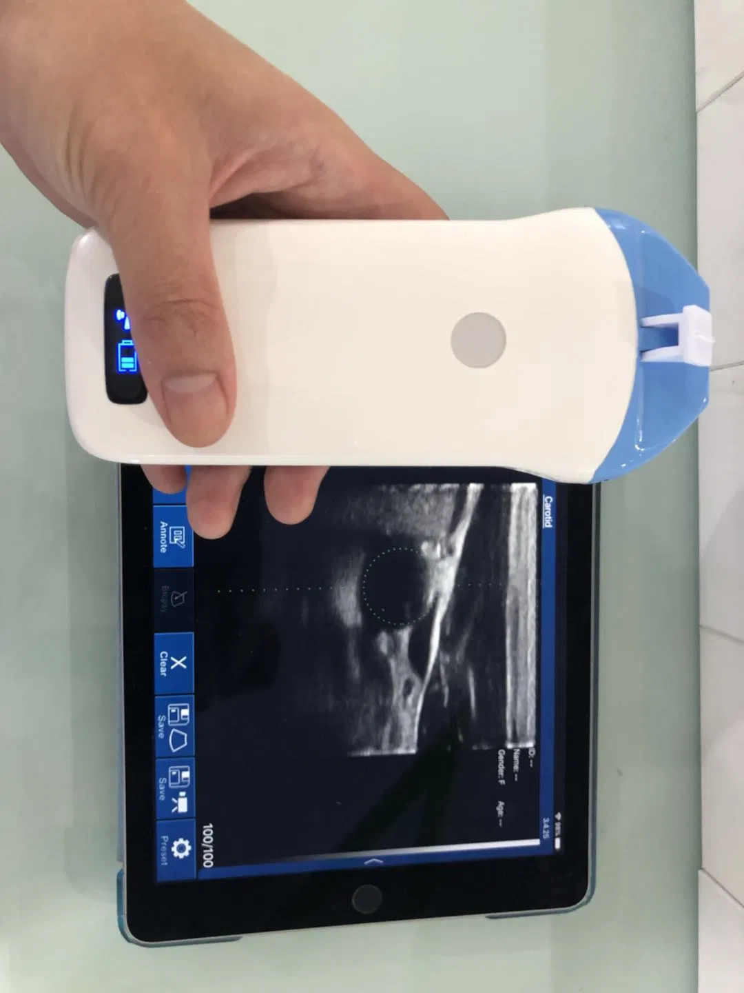 Portable Wireless Ultrasound Scanner Conevx Probe 3.5MHz Innovative Medical Device