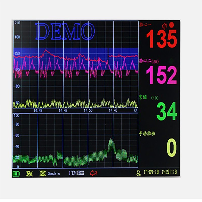 Medical Portable Infant Monitoring Maternal Monitor Doppler Fetal Monitor