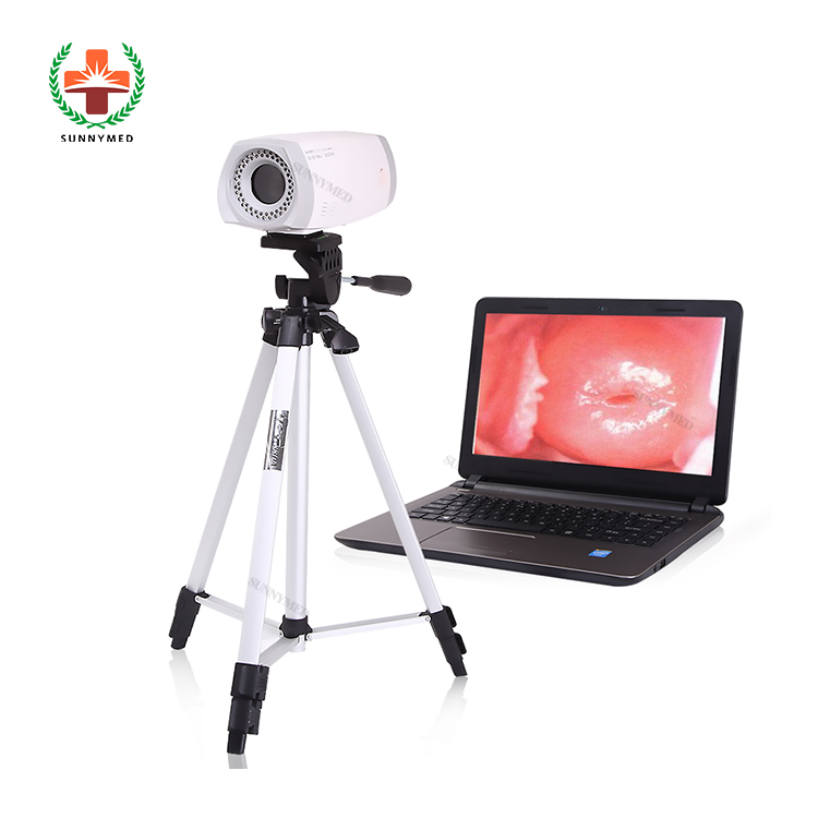 Sy-F003 Colposcope Digital Imaging System Gynecology Colposcope