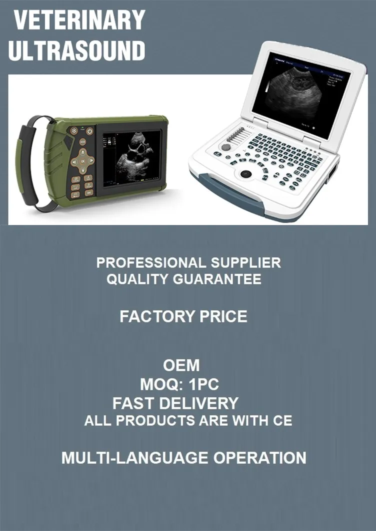 Handheld Portable Mobile Scanner System