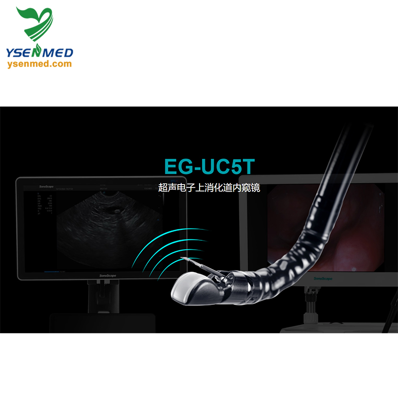 Medical Equipment Sonoscape Eg-UC5t, Linear-Array Echoendoscope Video Endoscopy System
