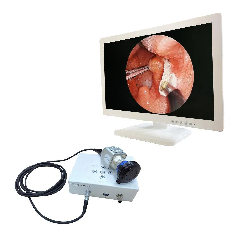 IN-HD7020 Surgical Hospital Medical Endoscopy Full Hd Digital Ent Endoscope Camera Ready To Ship All-in-one Endoscope Camera System