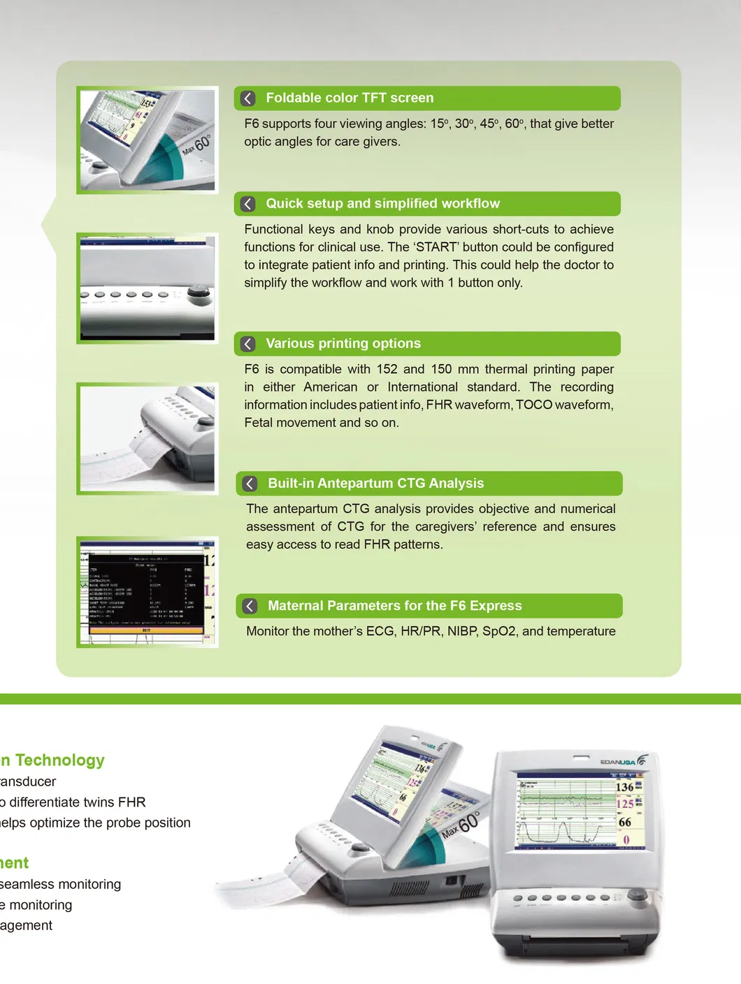 Fetal Monitor View 4