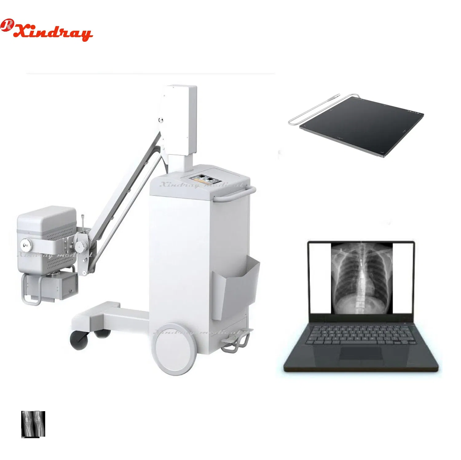 User-Friendly Touch Screen Digital Imaging Mobile X-ray Machine
