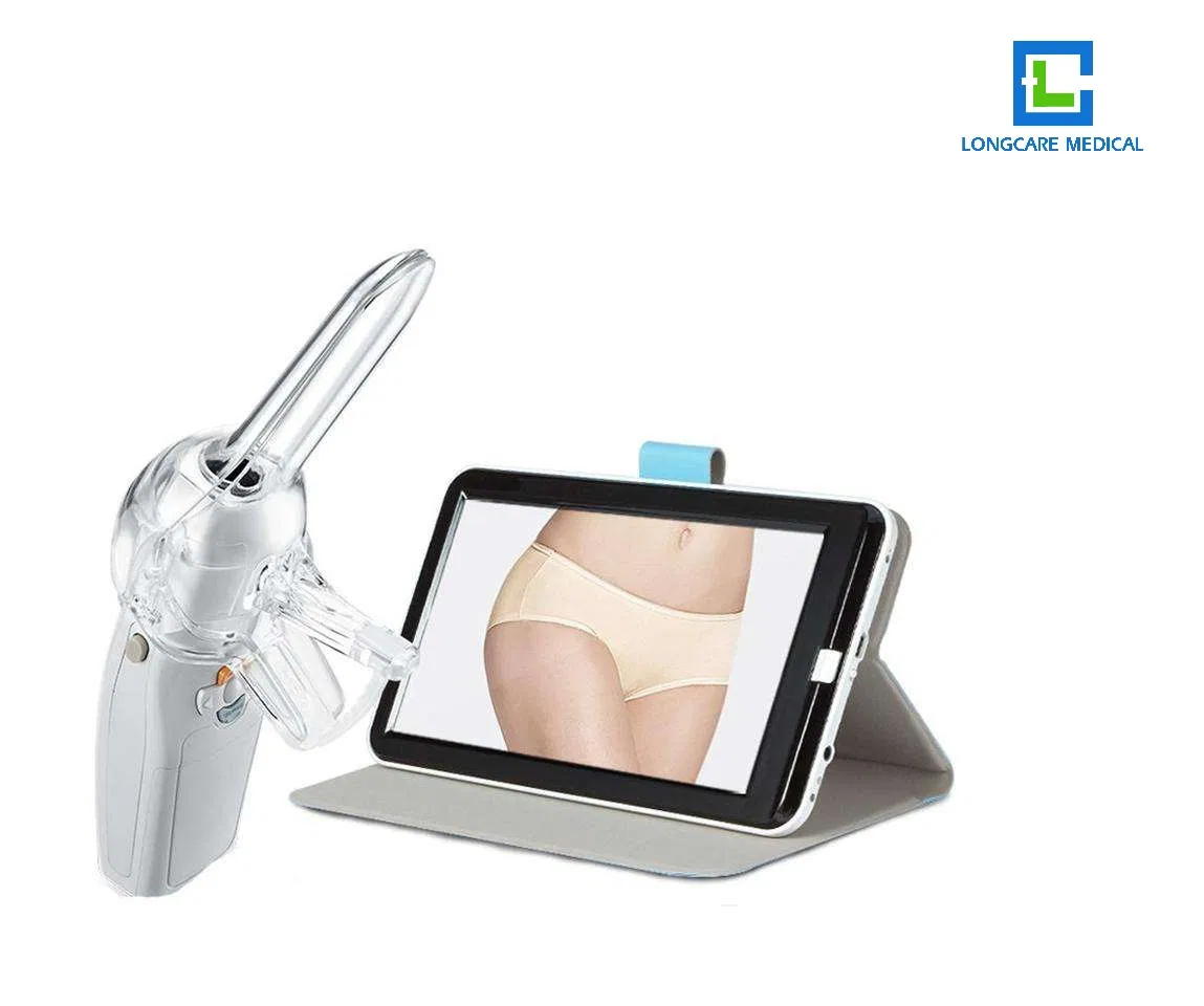 Portable Mini Colposcope Digital Video Colposcope