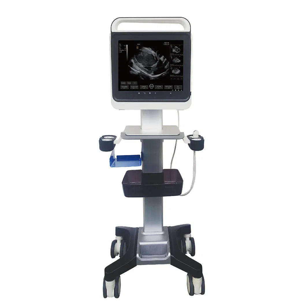 Hospital Clinic Touch Screen B/W Portable Ultrasound Devices