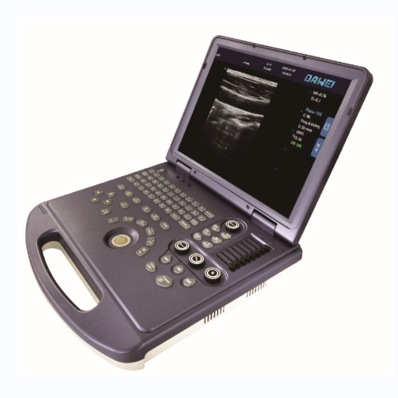 Laptop Ultrasound Device for Hospital 2023 New Arrival