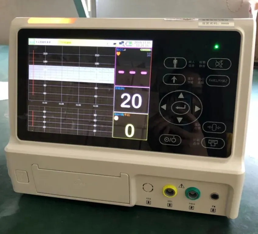 Fetal Monitor Parameters