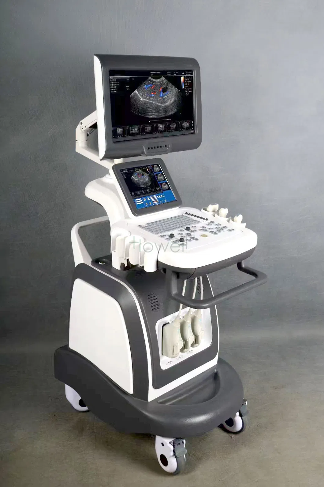 HE-S80 Ultrasound Device 4