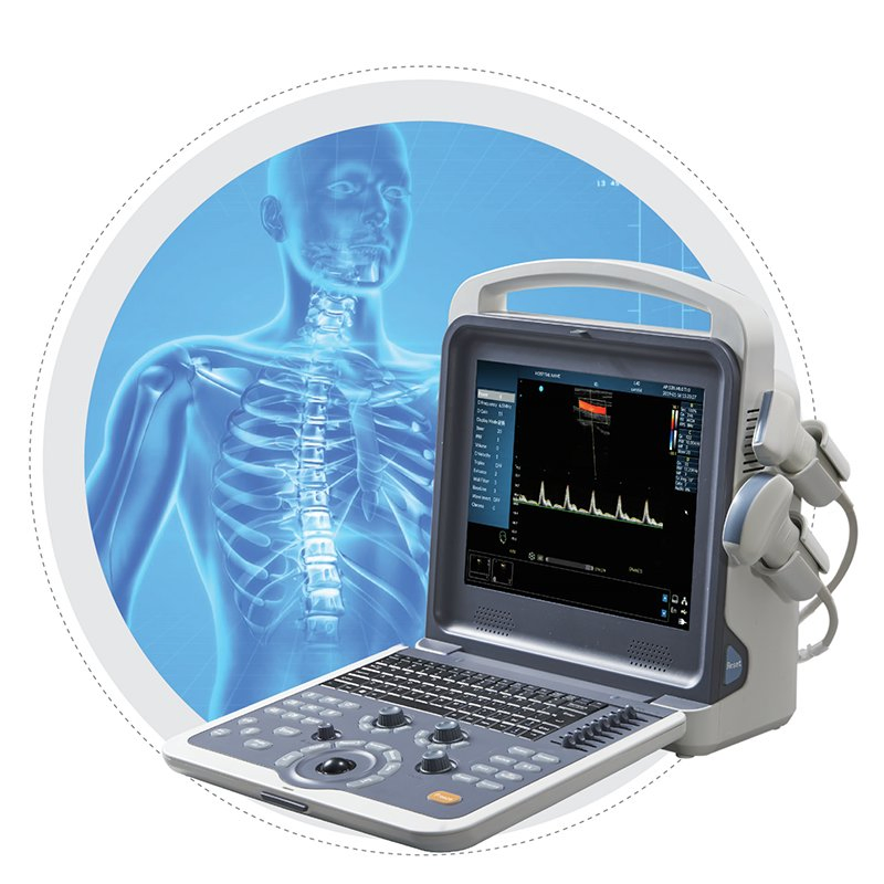 Umy Umus094 Advanced Color Doppler Ultrasonic Diagnostic Imaging System for Professionals